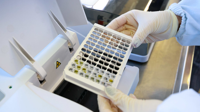 Paraíba implanta novo método para diagnóstico de leptospirose com tecnologia molecular no Lacen-PB